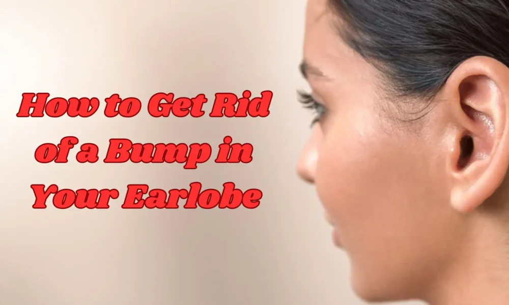 How to Get Rid of a Bump in Your Earlobe