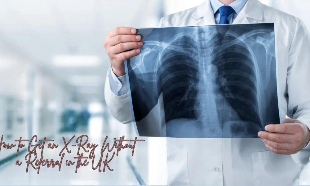 How to Get an X-Ray Without a Referral in the UK