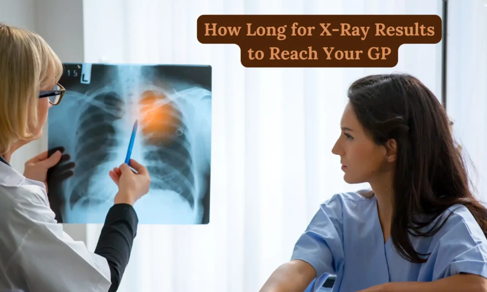 How Long for X-Ray Results to Reach Your GP