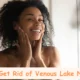 How to Get Rid of Venous Lake Naturally